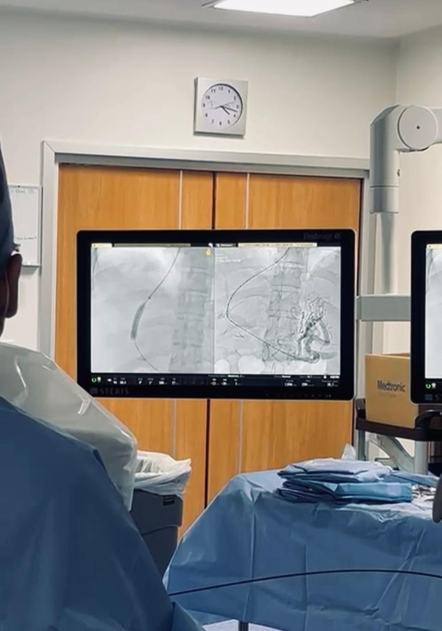 Tromboelastrografía Peri procedimental en Radiología Intervencionista